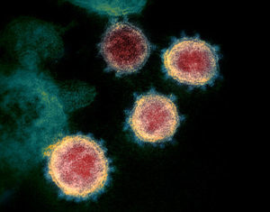 NIAID-RML image of coronavirus